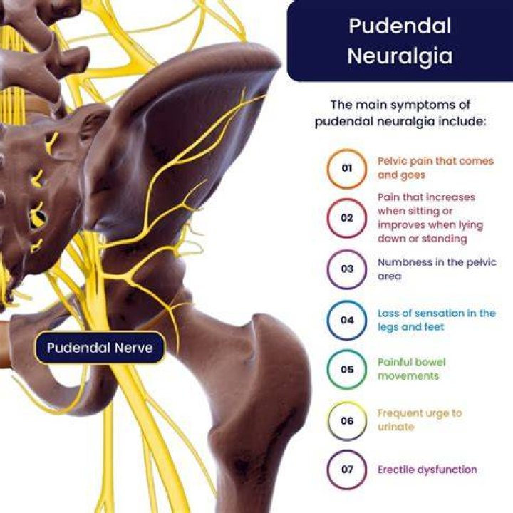 Can pudendal neuralgia heal on its own