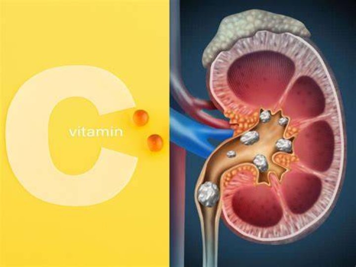 How does vitamin C affect kidney stones