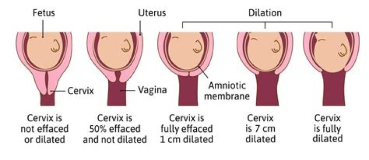 How many cm dilated does labor begin