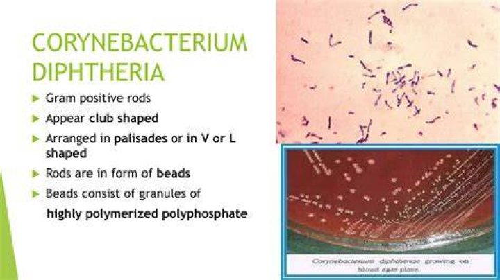 Is Diphtheria Gram negative or positive