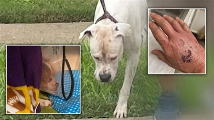 
North Carolina woman loses foot in horrific pit bull attack 