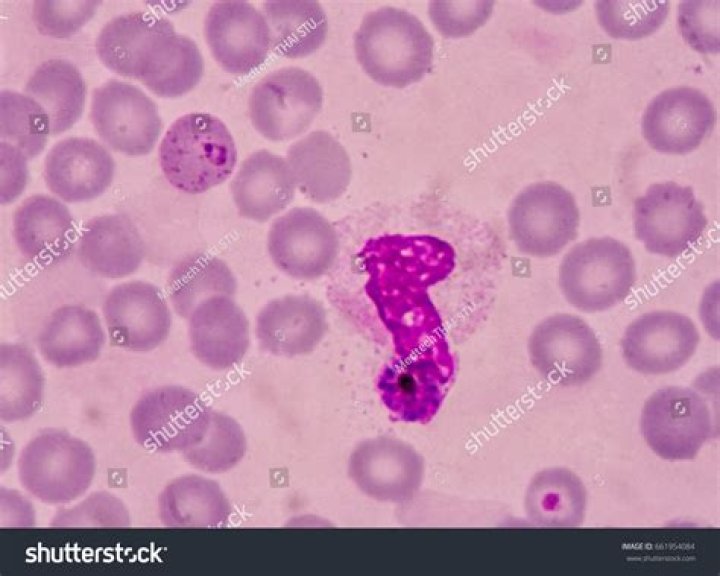 What does Plasmodium look like under a microscope