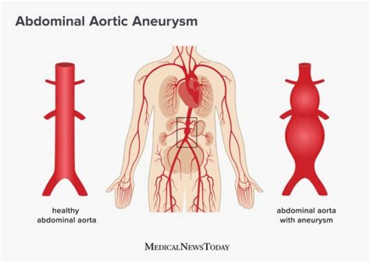 What does the abdominal aorta do