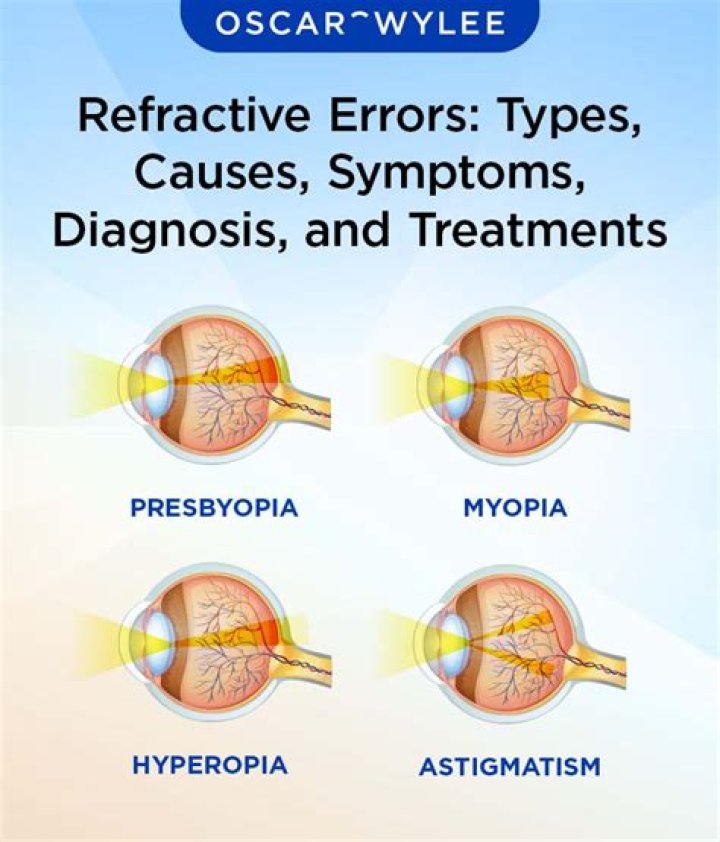 What is refractive eye