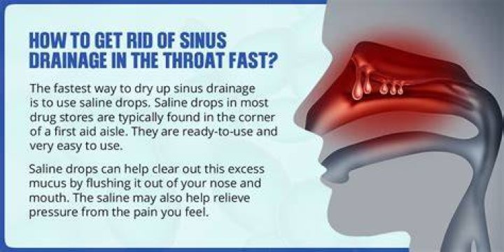 What will stop sinus drainage