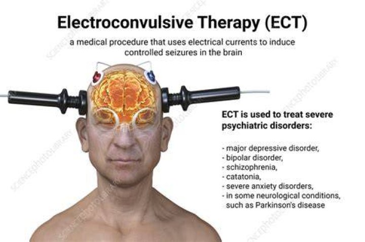 When did ECT start being used